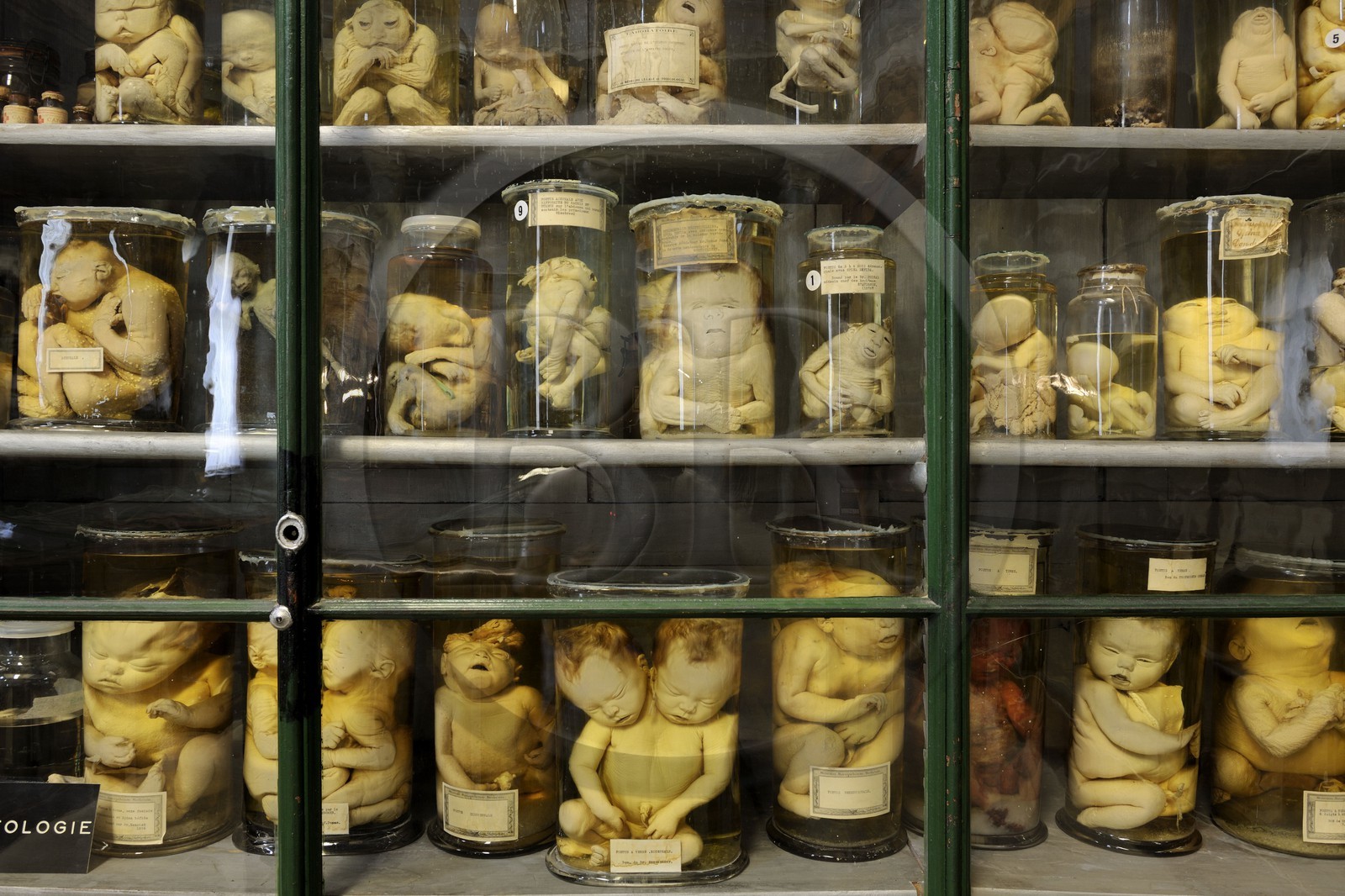 France, Hérault (34), Montpellier, centre historique, faculté de médecine, le musée d'anatomie, foetus de la collection de tératologie qui est l'étude scientifique des malformations congénitales